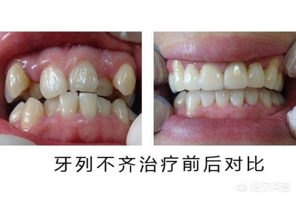 普洱最新24小时牙医在线咨询方法分析(最方便真实的普洱有没有24小时牙医方法)