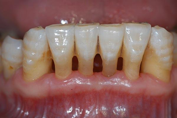 普洱最新24小时牙医在线咨询方法分析(最方便真实的普洱有没有24小时牙医方法)